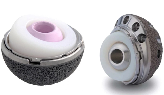 The MDM hip mobility implant put together