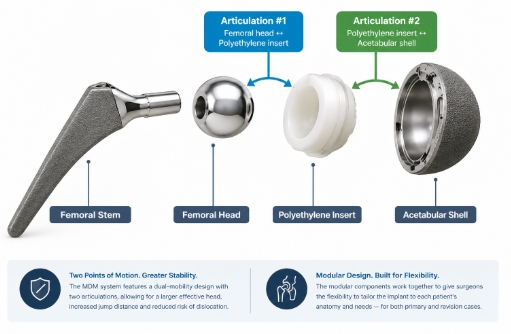 AI generated image of the dual mobility hip implant broken down with labels 
